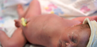 Jak dlouho může trvat novorozenecká žloutenka a co o ní potřebujete vědět